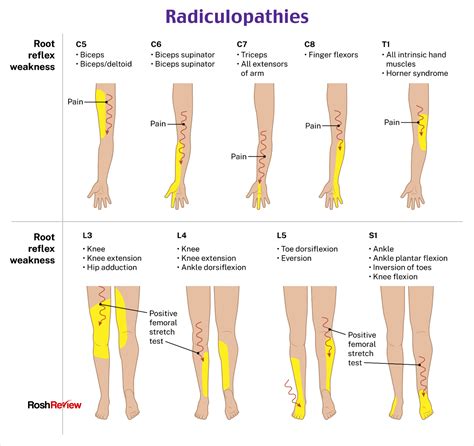 Icd 10 Codes For Deep Vein Thrombosis Dvt Of The Lower Extremity