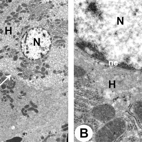 Transmission Electron Micrographs TEM Of The Livers Of AMD Plus SLM