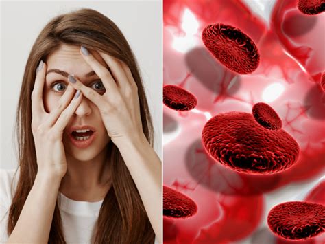 Iron Deficiency Signs In Eyes Holistic Nutritionist Shares 10 Foods To Fight Anaemia