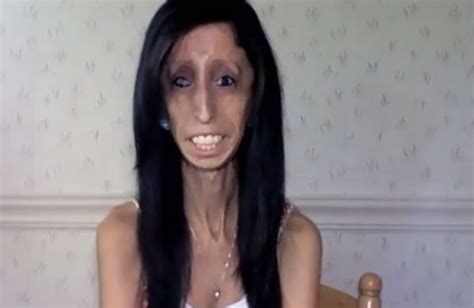 Thenextpicture Skinniest Person In The World Lizzie Velasquez