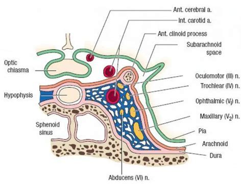 Pictures Of Cavernous Sinus