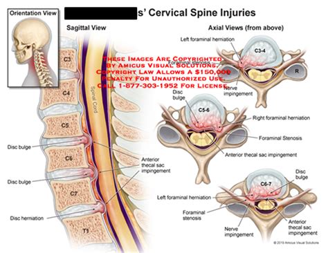 Medical Exhibits Demonstrative Aids Illustrations And Models