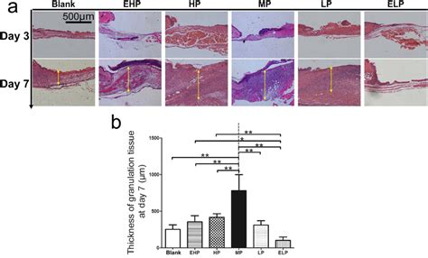 Formation Of Granulation Tissue A Hande Staining Of The Wound Tissue