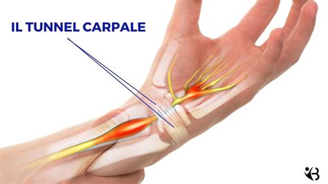 Sindrome Del Tunnel Carpale Sintomi Cosa Fare Esercizi E Quando