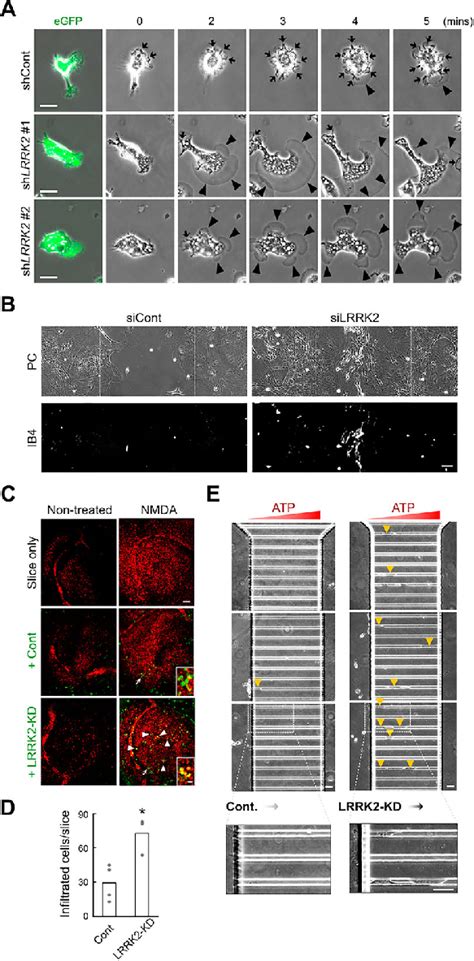 Knockdown Of Lrrk2 Enhances Migration Of Microglia A Time Lapse