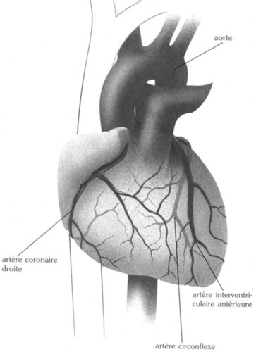 7 Chirurgie Cardiaque 2 Karteikarten Quizlet