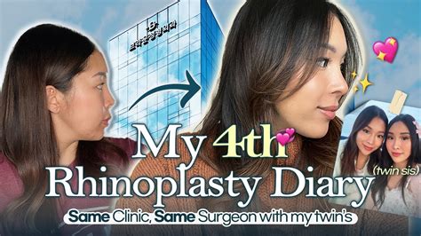 So This Is My 4th Rhinoplasty Journey Part 1 Twin S Plastic