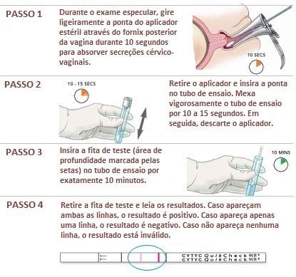 Teste Da Fibronectina Fetal Fetalmed Medicina Fetal Em Curitiba