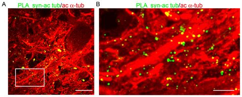 Ijms Free Full Text Acetylated α Tubulin And α Synuclein