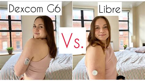 Dexcom G Vs Freestyle Libre Cgm Vs Flash Glucose Monitoring Full