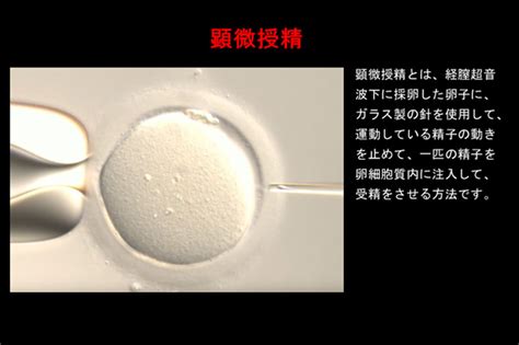 生殖補助医療（art）の意味と基本的な考え方｜治療の種類を解説 木場公園クリニック