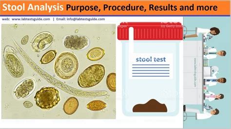 Stool Analysis Purpose Procedure Results And More Lab Tests Guide