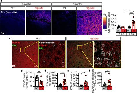 Increase Of Complement Factor C1q And Its Association With Psd 95 In