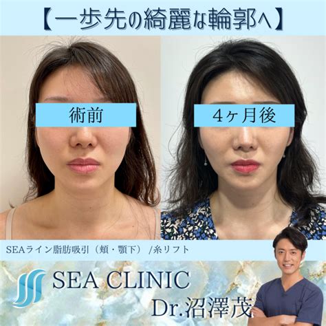 一歩先の綺麗な輪郭へ Sea Clinic −シークリニック 銀座― 理想を叶える小顔治療