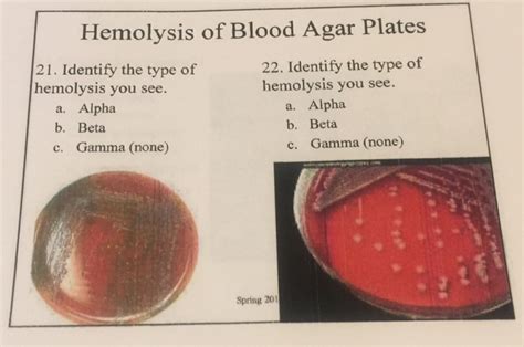 Solved Hemolysis of Blood Agar Plates 21. Identify the type | Chegg.com