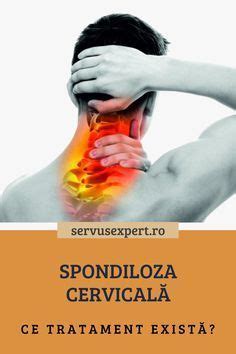 Spondiloza Cervicala Tratament Artofit