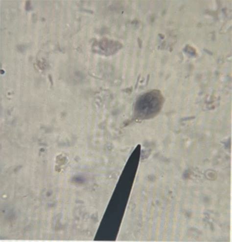 Microbiology Identification Of Protozoa Fungi Flashcards Quizlet