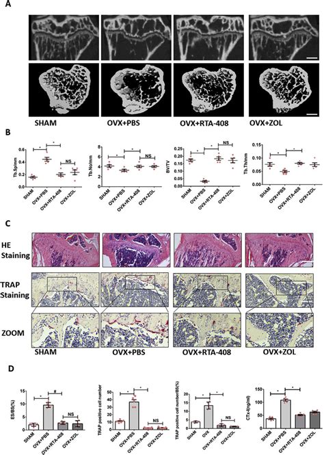 Rta Rescued The Ovx Induced Bone Loss In Vivo A Micro Ct