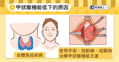 懶人包／讓人又累又變胖的甲狀腺機能低下 Ettoday探索 Ettoday新聞雲