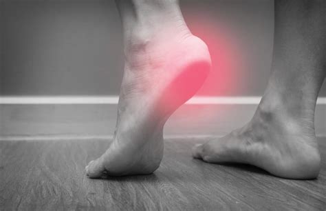 Treating Plantar Fasciitis Ethos Integrative Medicine