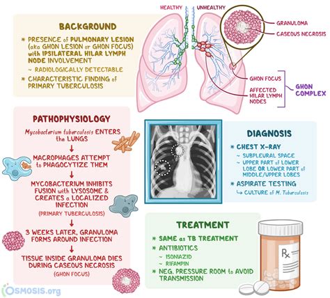 Ghon Complex: What Is It, Causes, Diagnosis | Osmosis