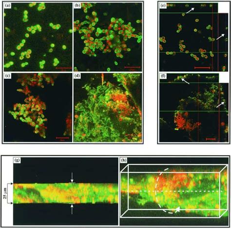 Biofilm Formation by the Fungal Pathogen Candida Albicans: Development ...