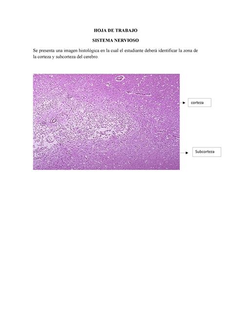 HOJA DE Trabajo Cerebro HOJA DE TRABAJO SISTEMA NERVIOSO Se Presenta