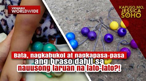 Bata Nagkapasa Pasa Ang Braso Dahil Sa Laruan Na Lato Lato Kapuso