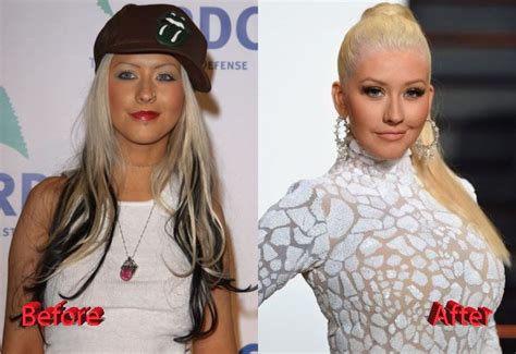 Christina Aguilera Before And After Cosmetic Surgery Christina