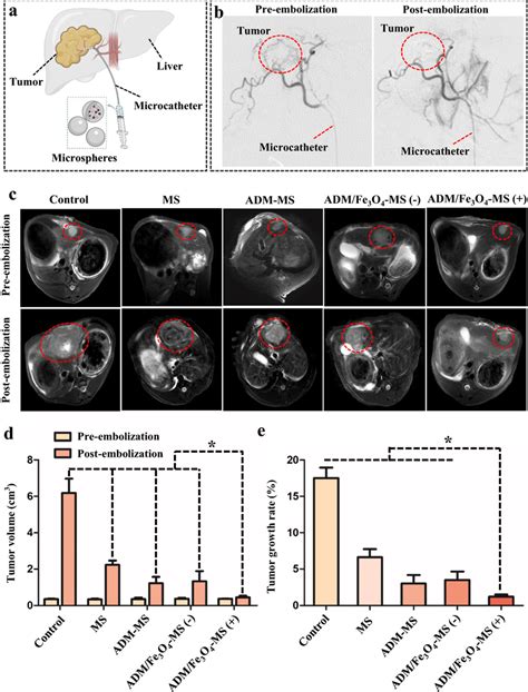 Tace Treatment Of The Rabbit Vx2 Orthotopic Liver Cancer Model And Its