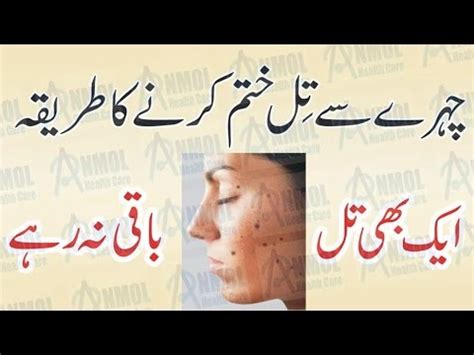 Chehre Se Til Hatane Ya Khatam Karne Ka Tarika Blackhead Removal