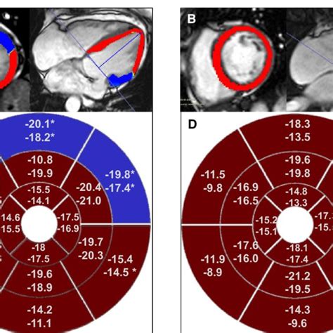 Circumferential And Longitudinal Peak Systolic Strain Analysis