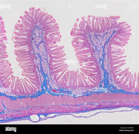 Small Intestine Light Micrograph Stock Photo Alamy