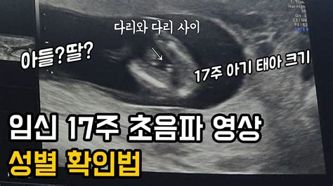 임신 17주 초음파 성별 구분법 태아 크기 배크기 몸무게 18개월 루리 영상 Youtube