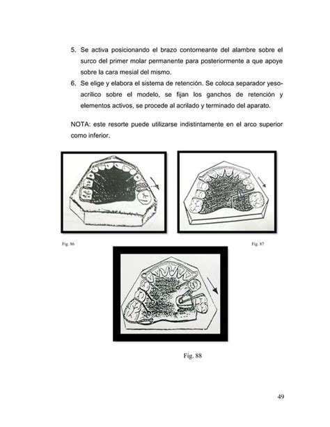 Manual De Ortodoncia Por Andrea Berrios Pdf