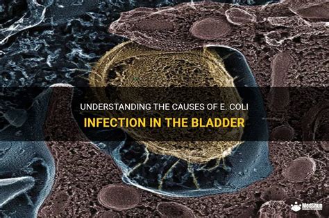 Understanding The Causes Of E Coli Infection In The Bladder Medshun