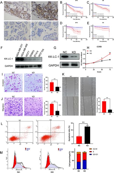 KK LC 1 Regulates The Malignant Biological Behaviors Of Triple Negative