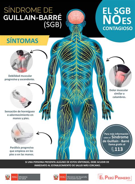 Información acerca del Síndrome de Guillain Barré SGB Noticias