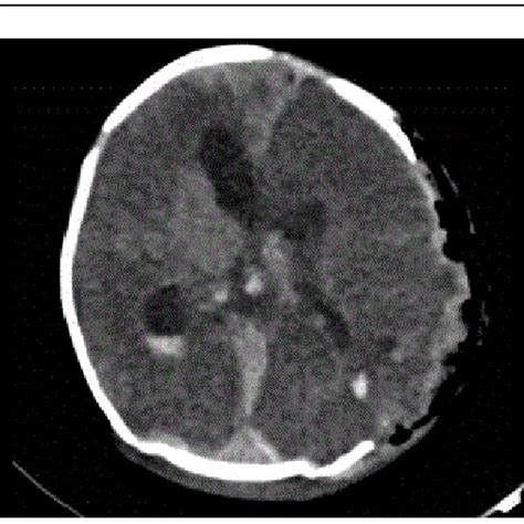 Brain CT with contrast. | Download Scientific Diagram