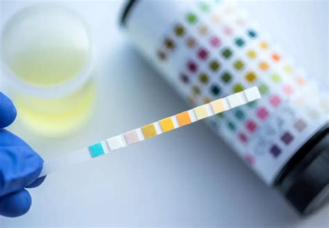 5 Panel Drug Test A Complete Guide For Employers Checkr