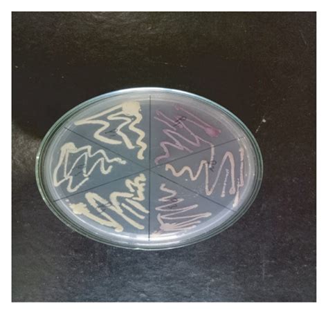 Subculture Colony Of Actinomycetes A Starch Casein Agar SCA Plate