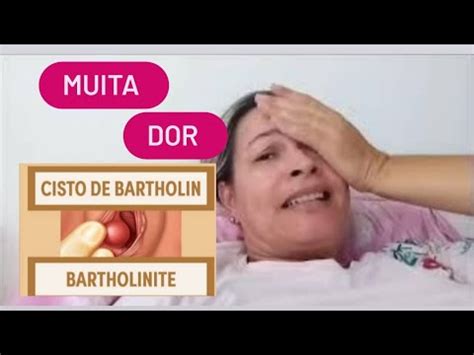 Minha experiência cisto de bartholin bartolinite não desejo