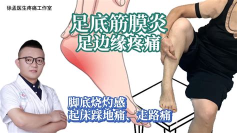 足底筋膜炎足边缘疼痛脚底烧灼感起床踩地痛走路痛 YouTube