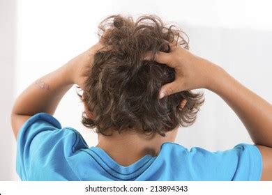 Itchy Scalp Head Lice Stock Photo 213894343 | Shutterstock