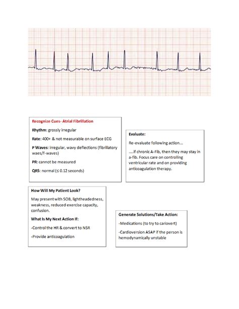 All EKG Strips EKG Rhythm Nur 265 Studocu