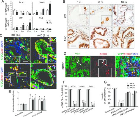 Atdc Up Regulates Zeb And Snail Expression And Induces Emt In Vivo