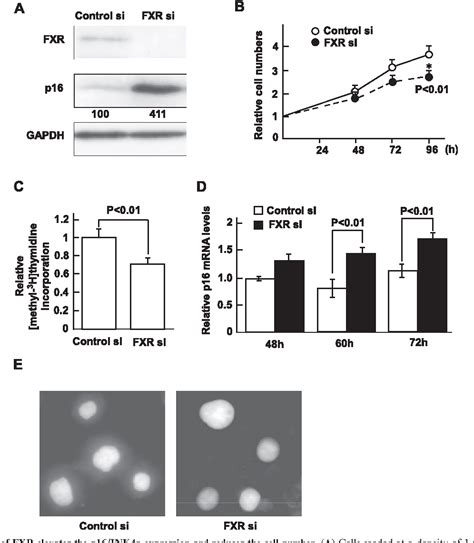 Figure 1 From Critical Role Of Farnesoid X Receptor For Hepatocellular