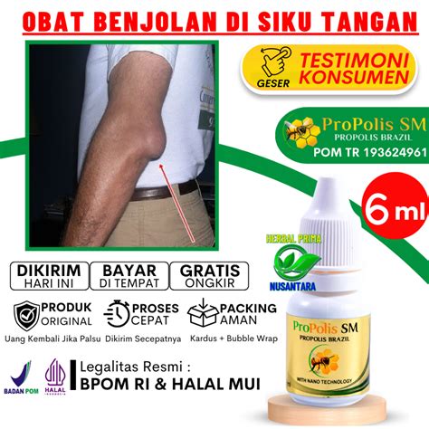 Jual Cod Obat Tetes Oles Benjolan Di Siku Kanan Kiri Obat Benjolan