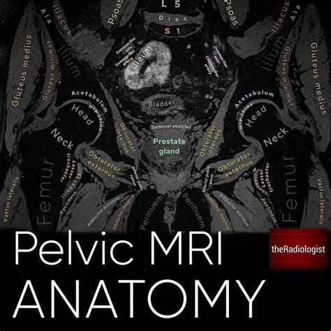 Theradiologist Sur Instagram Pelvic Mri Anatomy⁣ ⁣ 👨🏽‍💻heres An