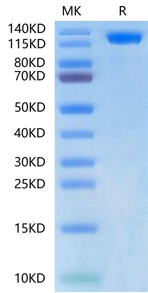 Biotinylated Human ACE2 ACEH Protein ACE HM501B